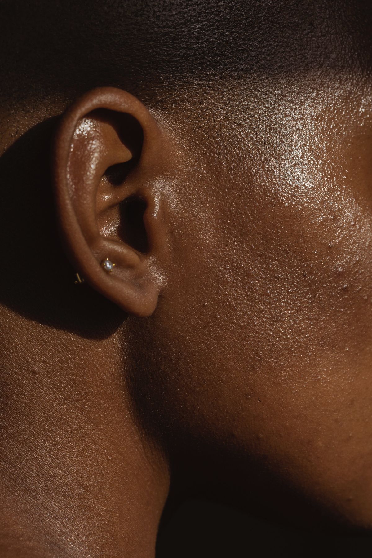 What is Ear Pinning (Otoplasty) Surgery and Could I Benefit From It?
